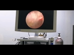 양성 전립선 비대증을 위한 RF 플라즈마 수술 시스템 비뇨기학 전극